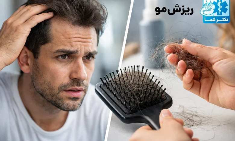 ریزش مو